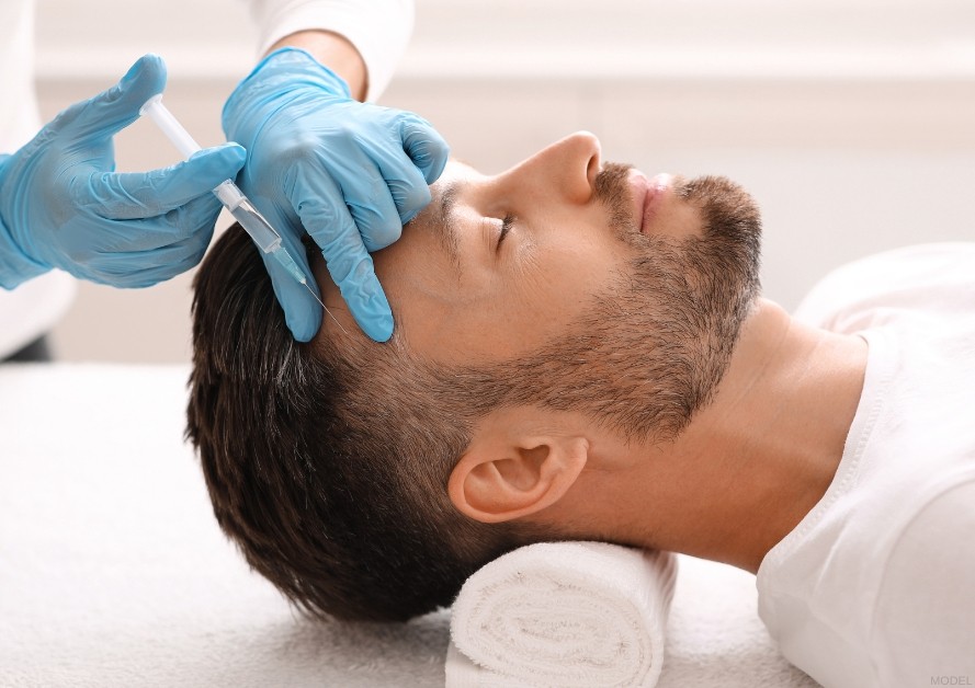 A man receiving a hair restoration treatment from a certified specialist (model)