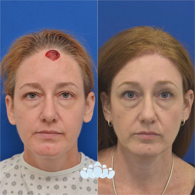 Skincare Products for Charlotte & Concord, NC Dilworth Facial Plastic