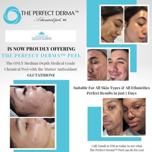 We are so excited to offer The Perfect Derma Peel to our patients! It is a medium depth peel that is packed with antioxidants and powerful acids that improve the clarity, tone, and texture of the skin. It is great for targeting and diminishing hyperpigmentation and improving the appearance of acne scars, as well as, keeping acne under control. The Perfect Derma Peel is also a fantastic treatment for anti aging, as it softens fine lines and wrinkles and stimulates the production of collagen and elastin. It really is a one peel fits all - suitable for all skin types and ethnicities!

Call us today to schedule your @theperfectdermapeel treatment with our Aesthetician, Allie!
📱980-949-6544

#theperfectdermapeel #chemicalpeel #skincare