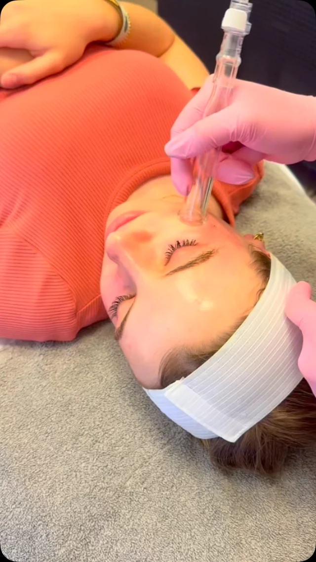 Glow like platinum ✨ 
Watch this Platinum HydraFacial work its magic for the ultimate deep cleanse, hydration, and glow!

#hydrafacial #skingoals #dilworthfacialplastics #charlotte