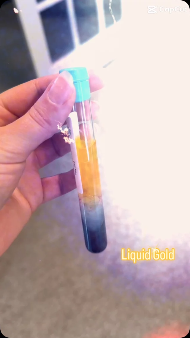 ✨PRP Eye Treatments = Liquid Gold✨

Say goodbye to tired, dull under-eyes. PRP (Platelet-Rich Plasma) uses your body’s own “liquid gold” to brighten, tighten, and refresh the delicate eye area—naturally. No fillers, no fluff—just real, radiant results. no.

Call or DM to schedule your treatment! 
☎️980-954-6544

#prp #charlotteaesthetics #liquidgold