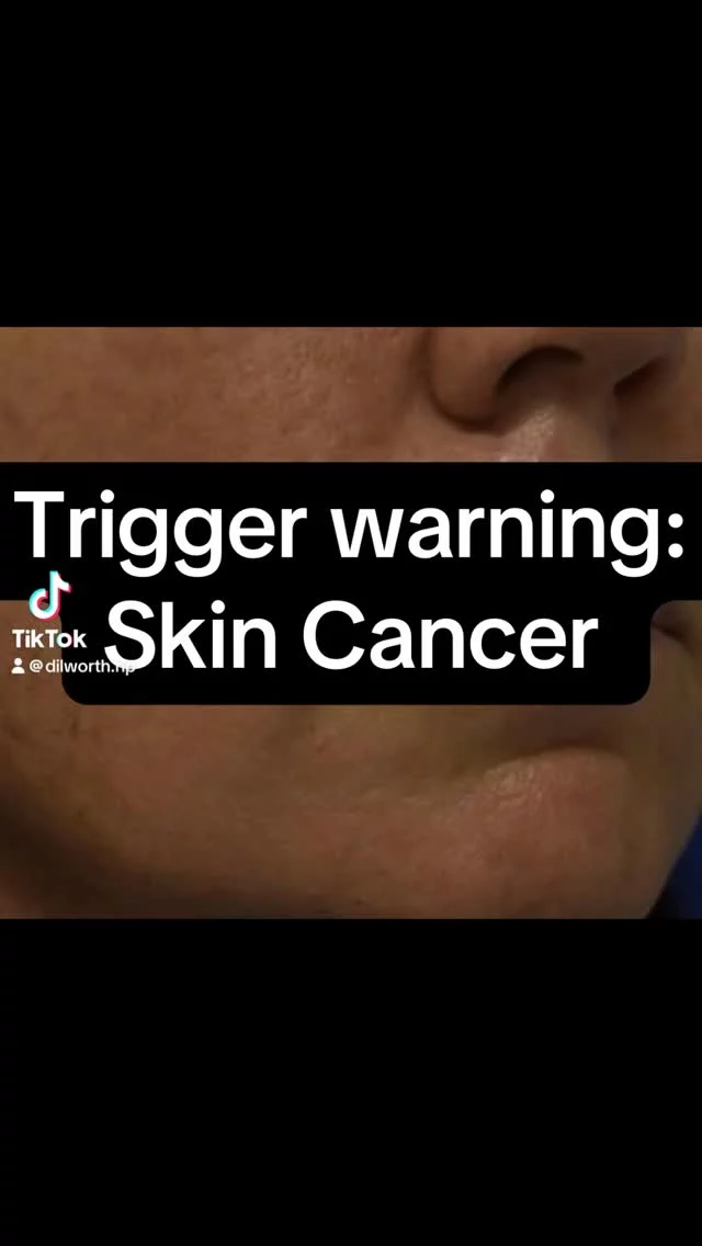 🔹May is Skin Cancer Awareness Month🔹

This is a powerful reminder that protecting your skin is more than just a beauty routine, it’s a health essential.

One in five Americans will develop skin cancer by the age of 70. But daily sunscreen use can reduce your risk. 

All month long, we’re offering 15% off all sunscreens to help make protection a part of your everyday!

#skincancerawareness #sunscreen #colorscience #eltamd