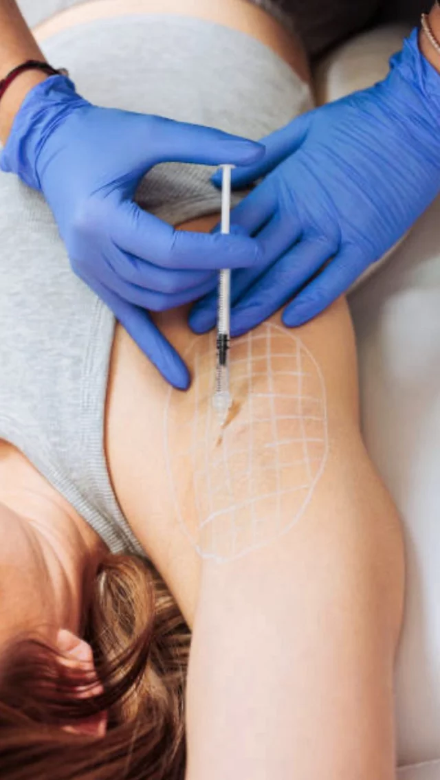 Say goodbye to sweat stains this summer! 💦
Did you know you can get underarm Botox to help reduce sweating? 🙌 And lucky for you — we’re offering $300 OFF underarm Botox for the entire month of June!

Book an appointment by DM or call to book your spot!
📞 980-949-6544

#underarmbotox #hyperhidrosistreatment #botoxforsweating #staydry #summerready☀️ #confidenceboost #nomoresweat #charlottebotox #charlotteaesthetics #nonsurgicalsolutions #beautyhacks #feelconfident #selfcare #summerskin #botoxdeals #glowup #underarmsweat #charlottenc