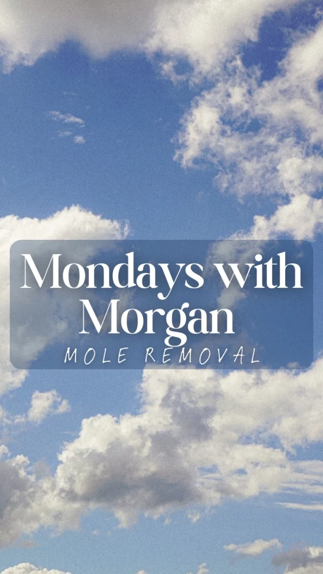 Mondays, Morgan & Mole Mysteries… oh my 👀
Come see us for all your mole removal needs! 

Mole removal, cosmetic mole removal, dermatology treatments, clear skin tips, skin confidence, healthy glowing skin, mole removal procedure, skin care solutions, smooth skin results, cosmetic dermatology, skin spot removal, safe mole removal, flawless skin, skincare clinic, skin health, Charlotte skincare, Charlotte mole removal, Dilworth Facial Plastics