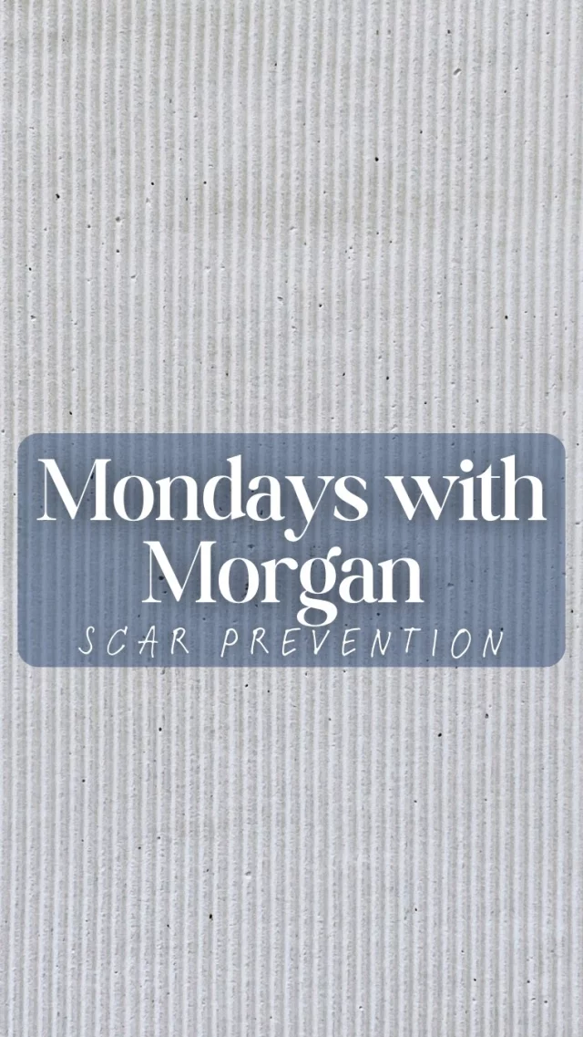 Your incision’s new BFFs: silicone, sunscreen, and time. ⏳🩹 Tune in with Morgan & Cassie on this week’s episode of Mondays with Morgan! 

Scar prevention tips, post surgery scar care, how to heal after surgery, best scar prevention methods, plastic surgery recovery tips, Mondays with Morgan, Dilworth Facial Plastics, Charlotte plastic surgery, skincare after surgery, smooth scar healing, incision care tips, funny bloopers, outtakes, behind the scenes moments, medical team advice, scar prevention with Morgan and Cassie, plastic surgery healing journey, post op skincare routine, silicone and sunscreen for scars, surgical scar prevention tips, Charlotte med spa content